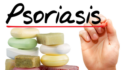 The Benefits of Handmade Soap for Psoriasis: Nurturing Your Skin with Natural Care